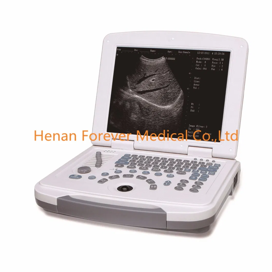 4D Ecografo Maquina De Ultrasonido 3D 4D&4D Ultrasound Scanner