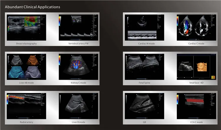 Bt-Ud91 Full Digital Color Doppler System Portable Ultrasound Machine