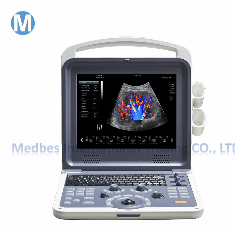 Ce Marked 2D Portable Type Color Doppler