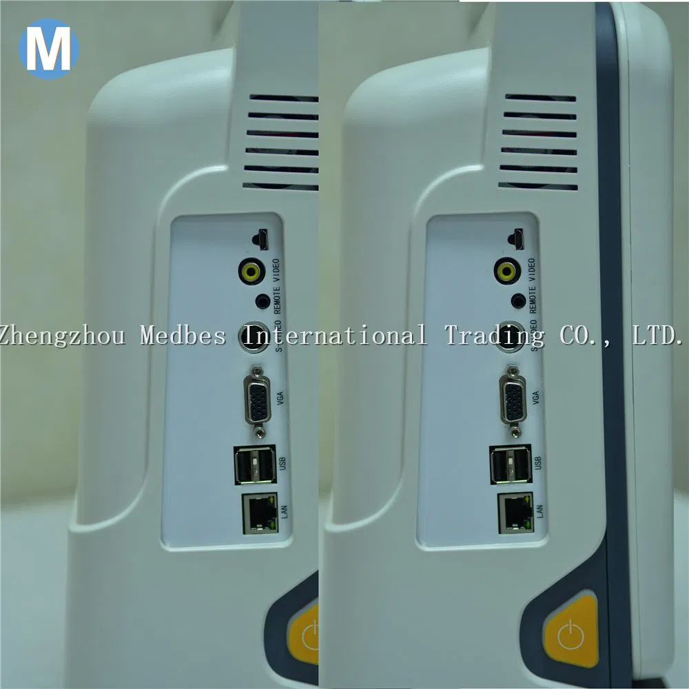 Digital Diagnostic System 2D Ultrasound Machine