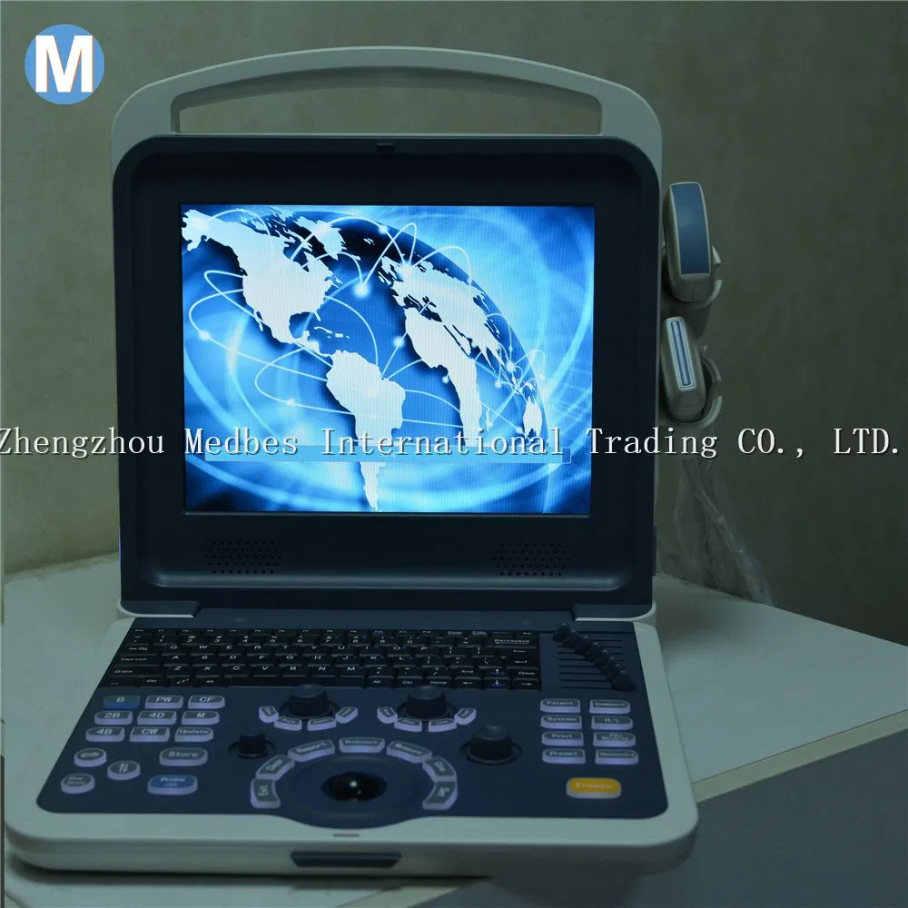 Digital Diagnostic System 2D Ultrasound Machine