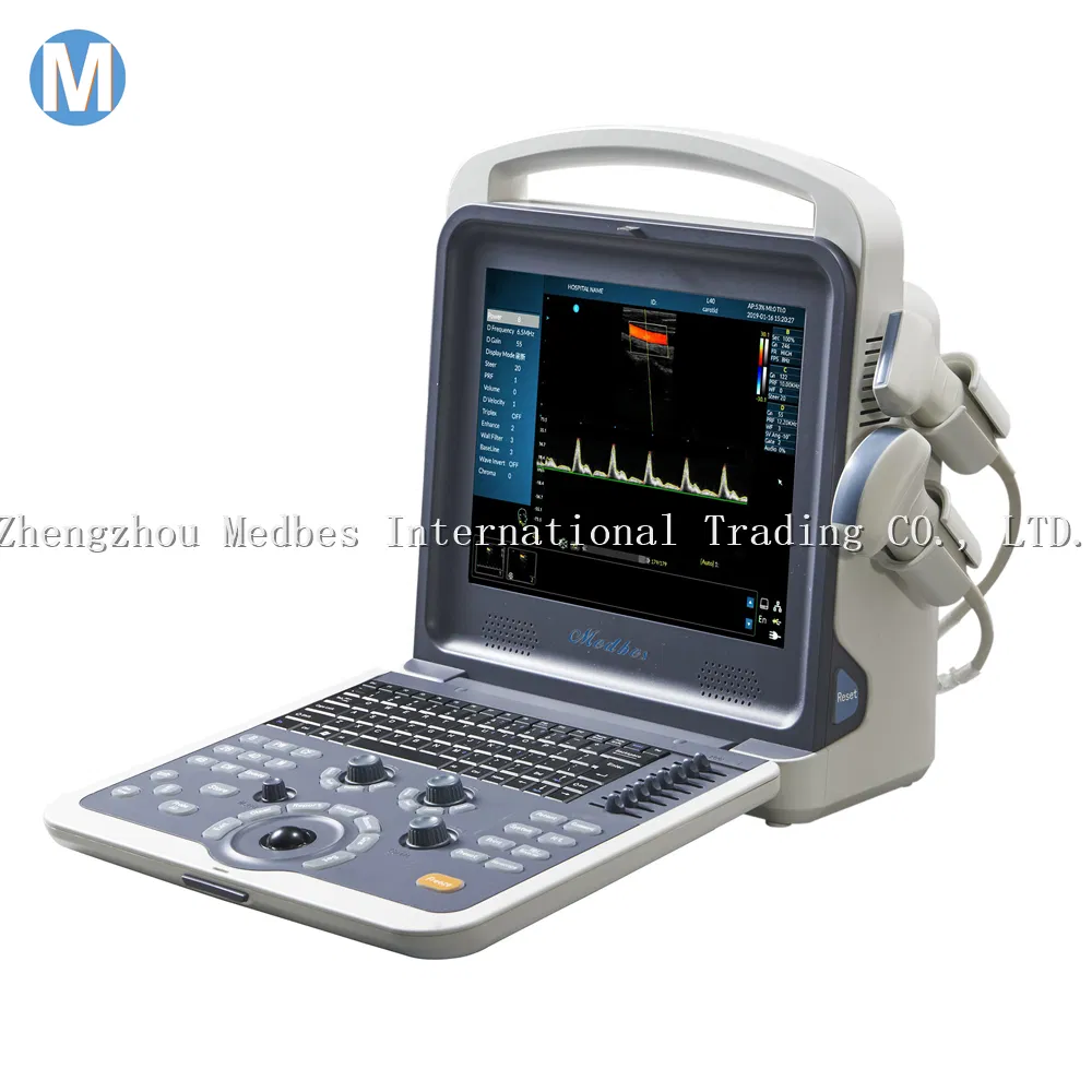 Digital Diagnostic System 2D Ultrasound Machine