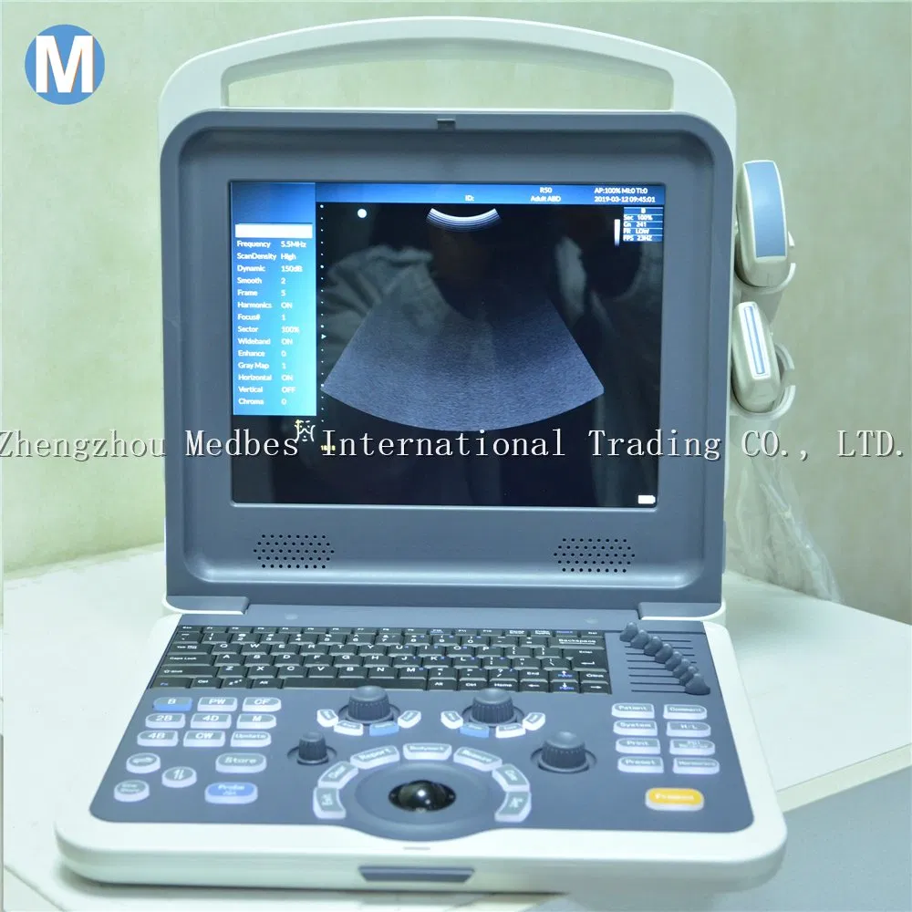 Digital Diagnostic System 2D Ultrasound Machine