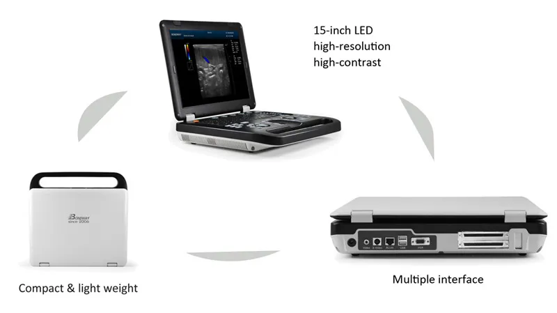 Digital Veterinary Ultrasound Color Doppler with Rechargeable Battery, Equine, Bovine, Canine, Feline, Canine, Ovine, etc