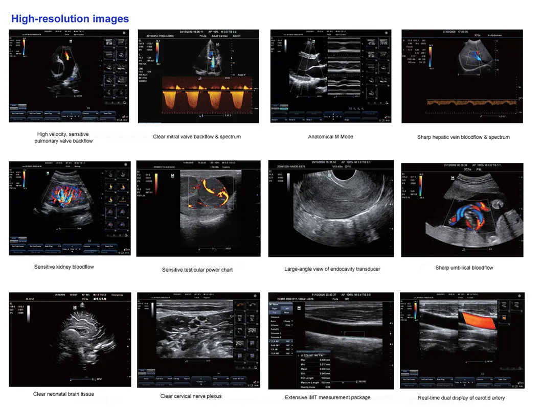 Digital Veterinary Ultrasound Color Doppler with Rechargeable Battery, Equine, Bovine, Canine, Feline, Canine, Ovine, etc