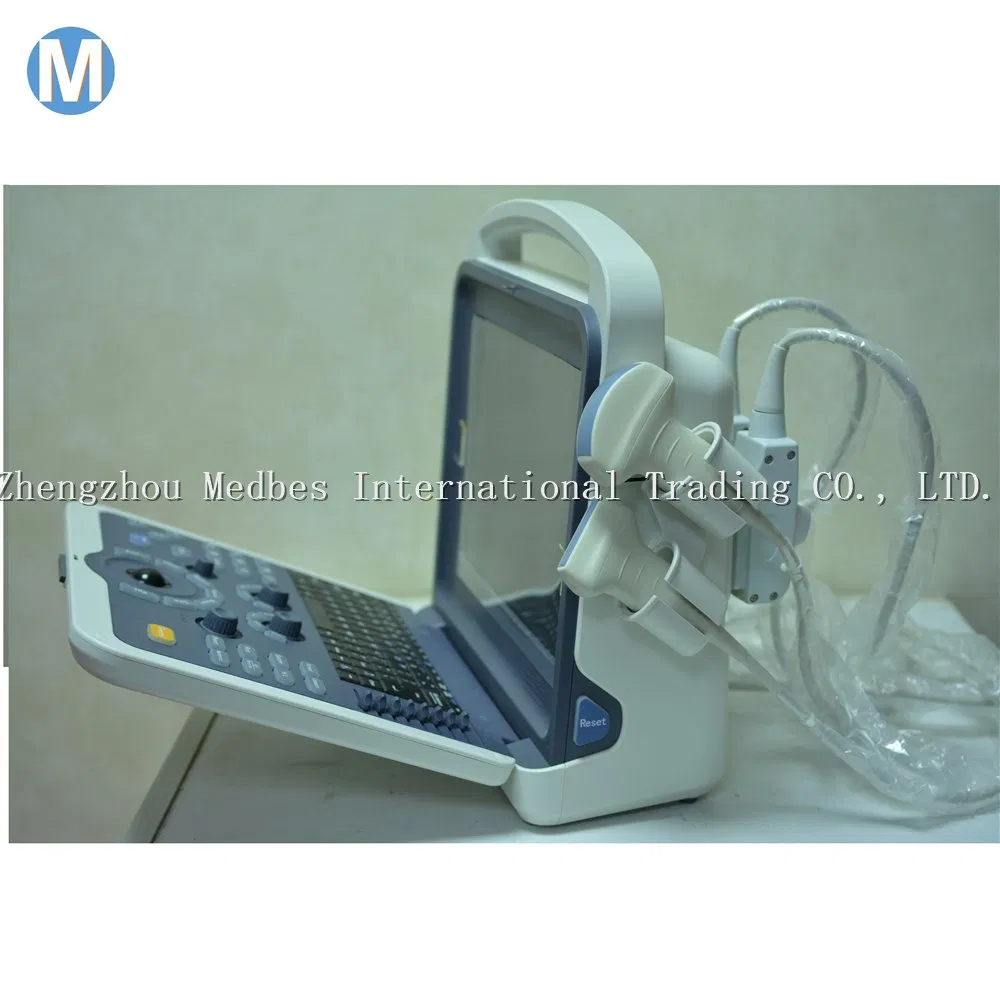 Economical Digital Pregnancy Ultrasonic Ultrasound Scanner