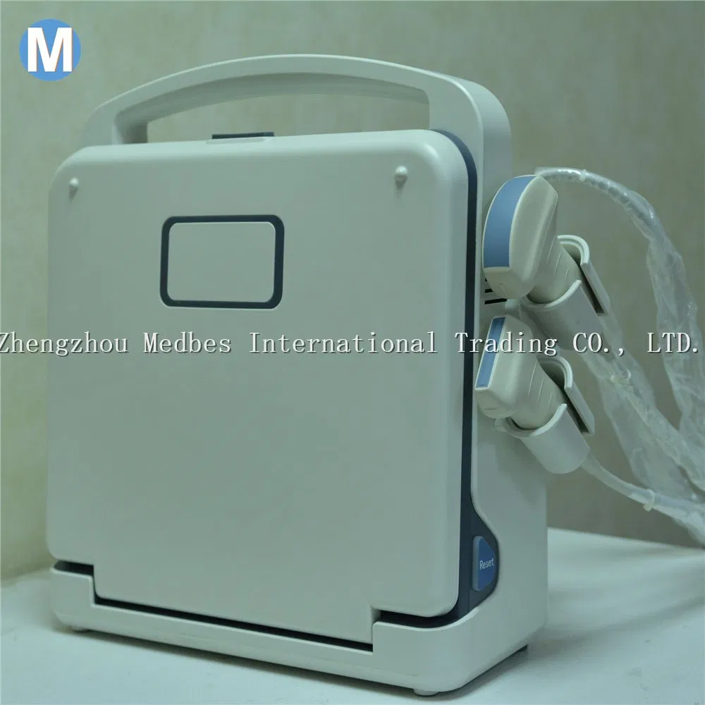 Economical Digital Pregnancy Ultrasonic Ultrasound Scanner