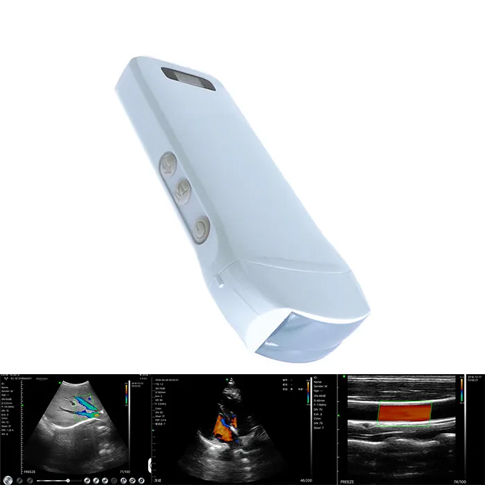 Handheld Portable Wireless Ultrasound Color Doppler High Frequency Diagnostic Scanner