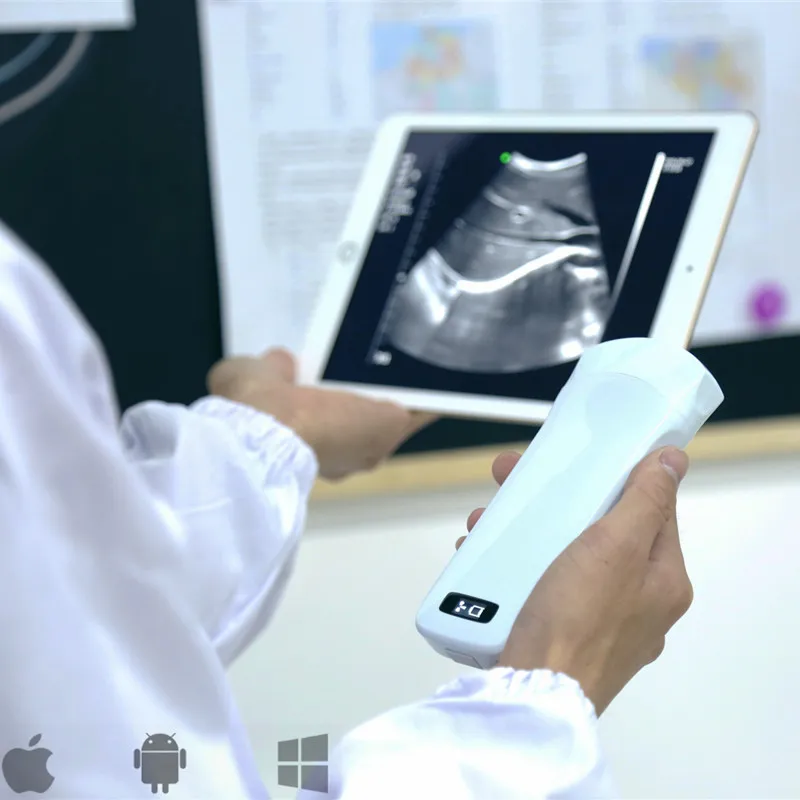 Handheld Portable Wireless Ultrasound Color Doppler High Frequency Diagnostic Scanner