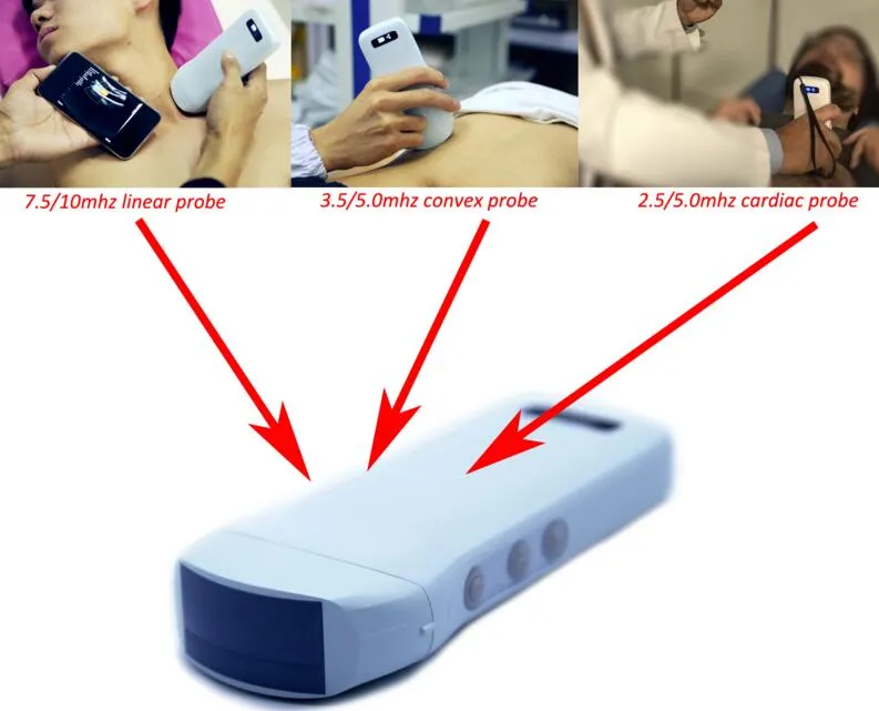 Handheld Portable Wireless Ultrasound Color Doppler High Frequency Diagnostic Scanner