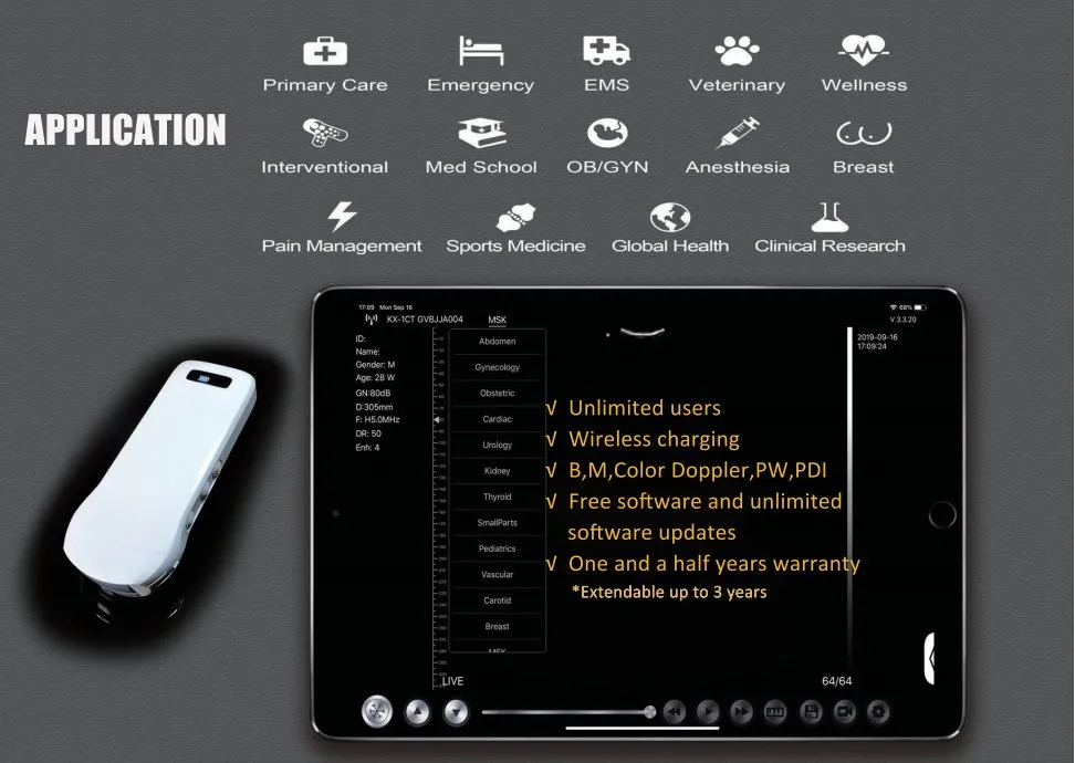 Handheld Portable Wireless Ultrasound Color Doppler High Frequency Diagnostic Scanner