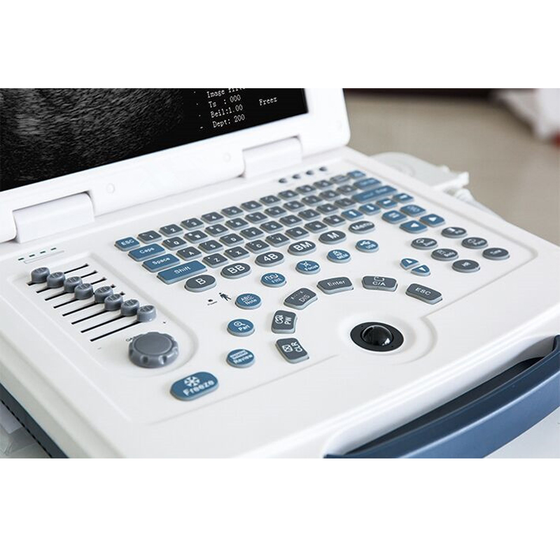 Hc-A003 High Quality Full Digital Portable Laptop Ultrasound Scanner