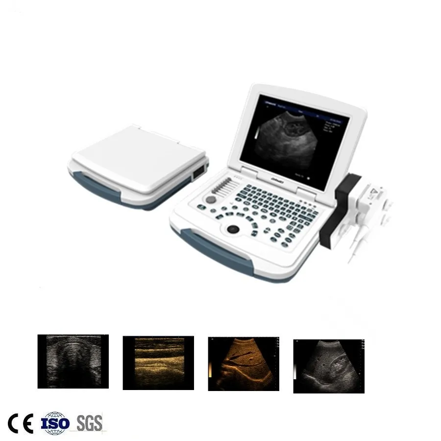 High Quality Full Digital Portable Obstetric Echocardiography Ultrasound Scanner Machine