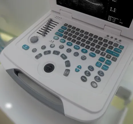 High Quality Full Digital Portable Obstetric Echocardiography Ultrasound Scanner Machine
