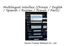 Hot Selling Full-Digital Color Doppler Ultrasound Scanner (YJ-U60PLUS)