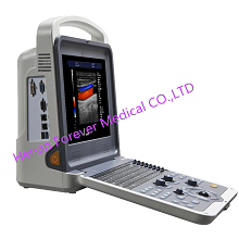 Hot Selling Full-Digital Color Doppler Ultrasound Scanner (YJ-U60PLUS)