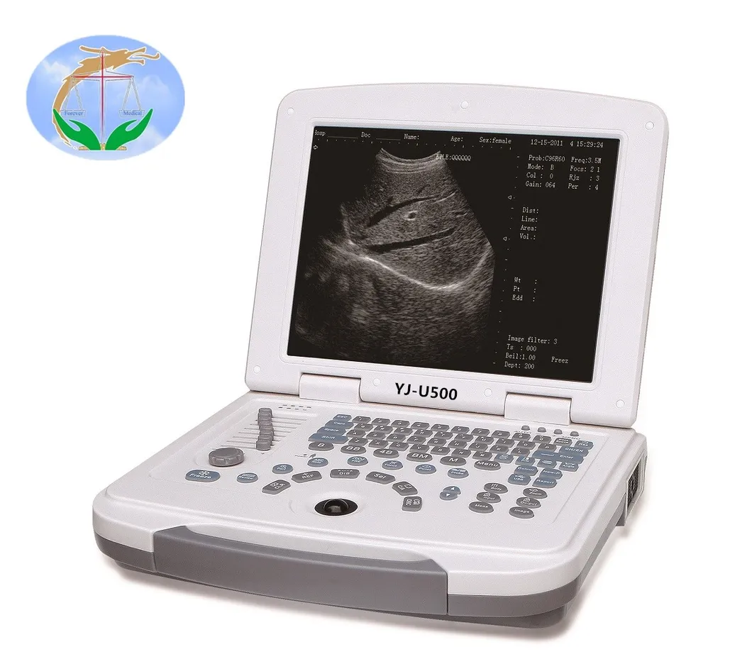Laptop Ultrasound Machine, Portable Black and White Ultrasound Machine