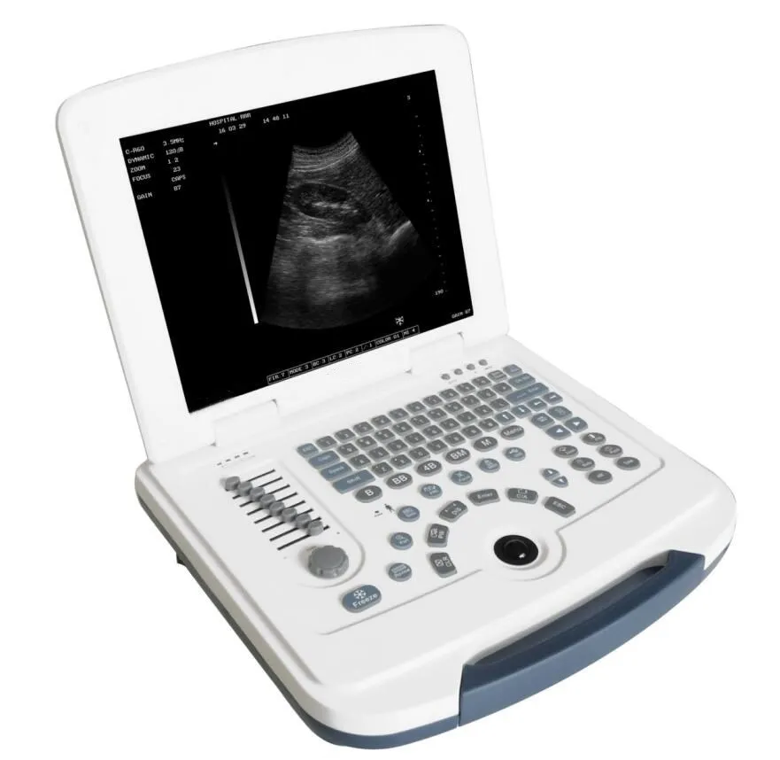 Laptop Ultrasound Machine, Portable Black and White Ultrasound Machine