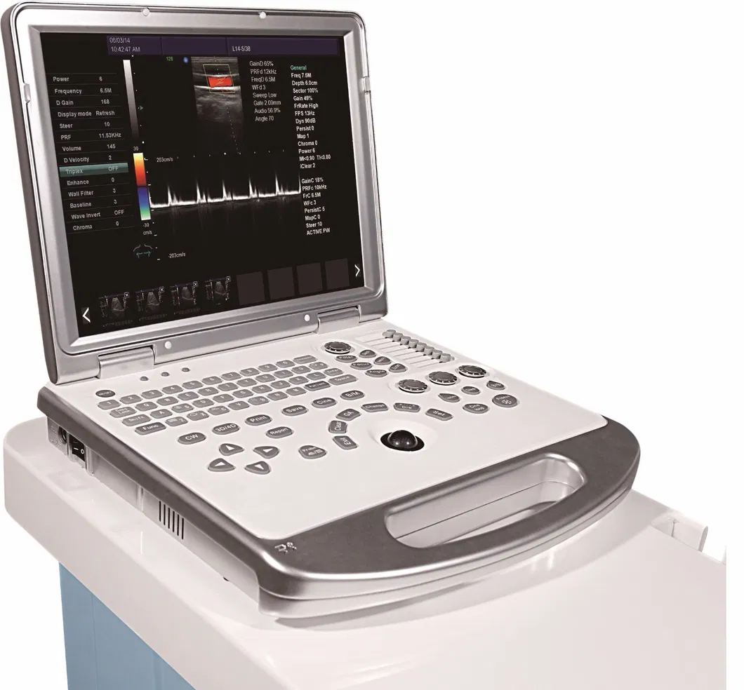 Laptop Ultrasound Machine, Portable Black and White Ultrasound Machine