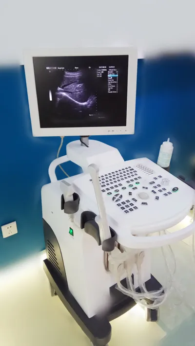 Movalbe Ultrasound Scanner Trolley Made in China