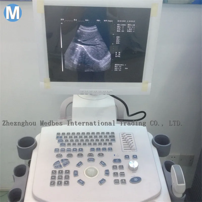 Movalbe Ultrasound Scanner Trolley Made in China