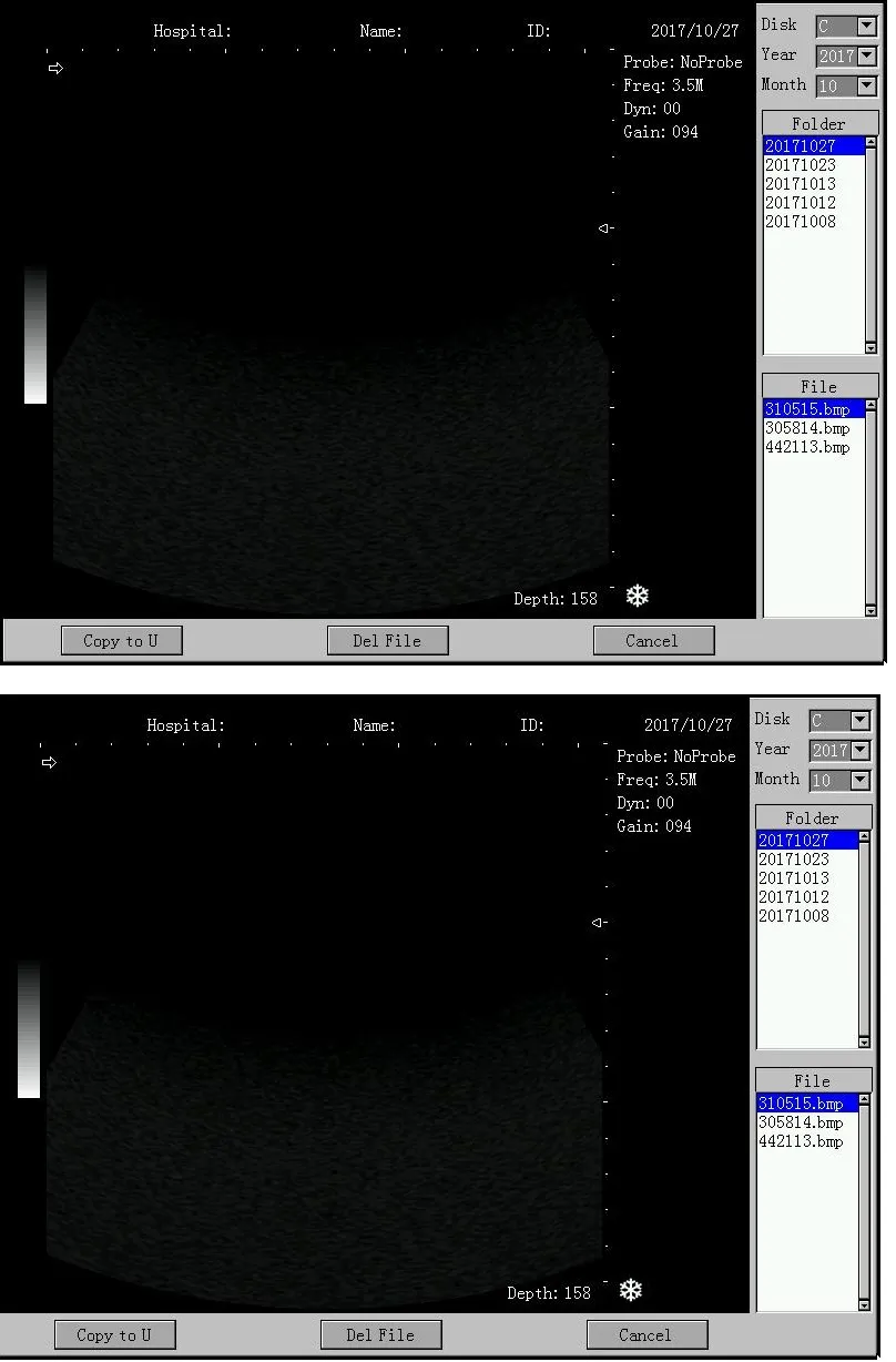 Movalbe Ultrasound Scanner Trolley Made in China