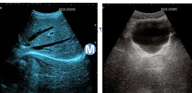 Movalbe Ultrasound Scanner Trolley Made in China