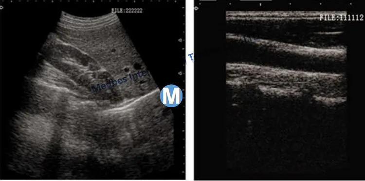 Movalbe Ultrasound Scanner Trolley Made in China