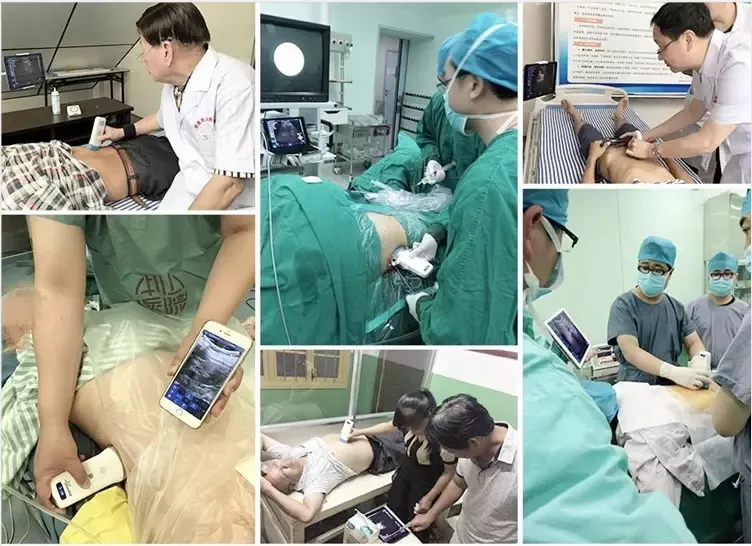 Mt Medical B B/M Pw Pdi Color 3 in 1 Handheld Portable Ultrasound