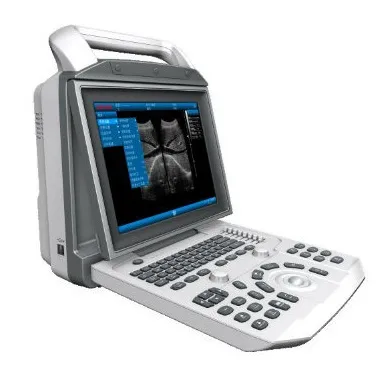 PT6150 Portable Ultrasound System with LCD, Color Doppler Generate Incredible Ultrasound Images