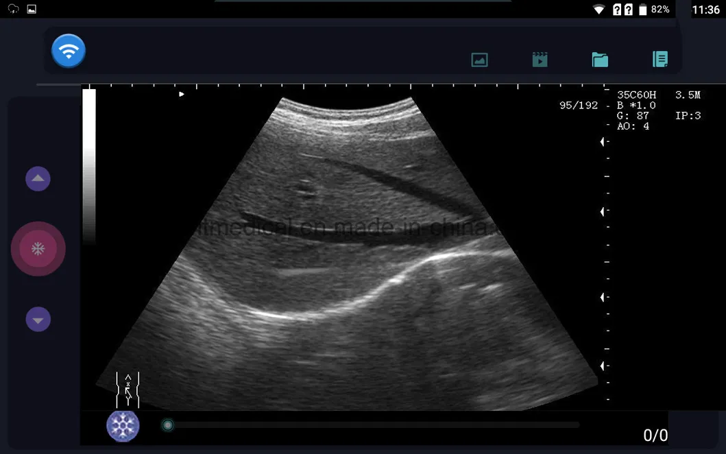 Three-in-One Wireless HD Imaging Color Doppler Ultrasound/128 Matrix HD Ultrasound Color Doppler Scanner/2D Portable Ultrasound Doppler