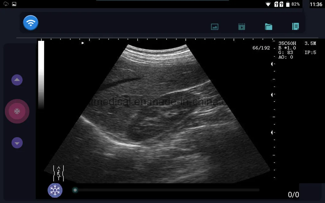 Three-in-One Wireless HD Imaging Color Doppler Ultrasound/128 Matrix HD Ultrasound Color Doppler Scanner/2D Portable Ultrasound Doppler